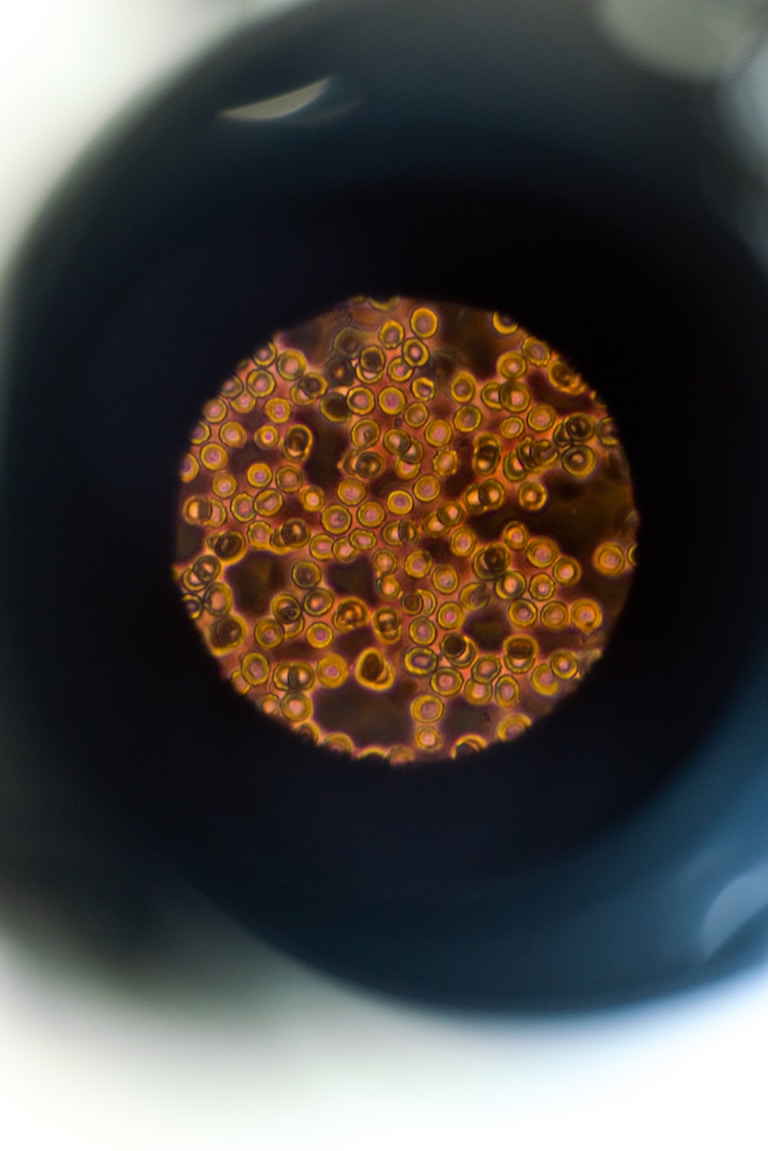 A circular microscopic view of mutually reflecting gas bubbles in an electrolyzed blood sample.